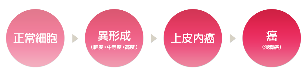 婦人科診療|子宮頚部異形成