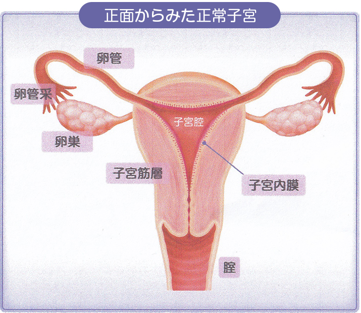婦人科診療|子宮筋腫(正面からみた正常子宮)