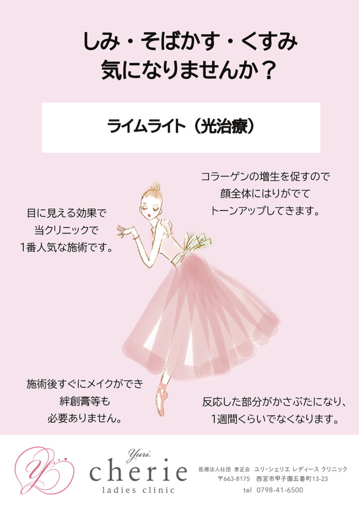 ライムライト