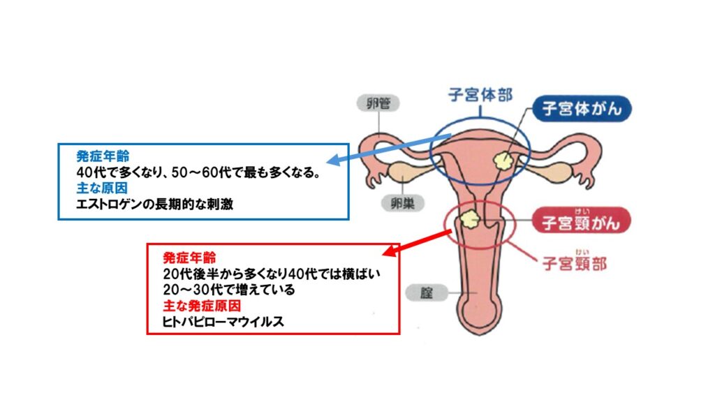 婦人科診療|子宮頚癌・子宮体癌